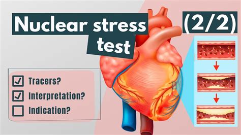 is nuclear stress test hard on kidneys|can nuclear stress test interfere with.